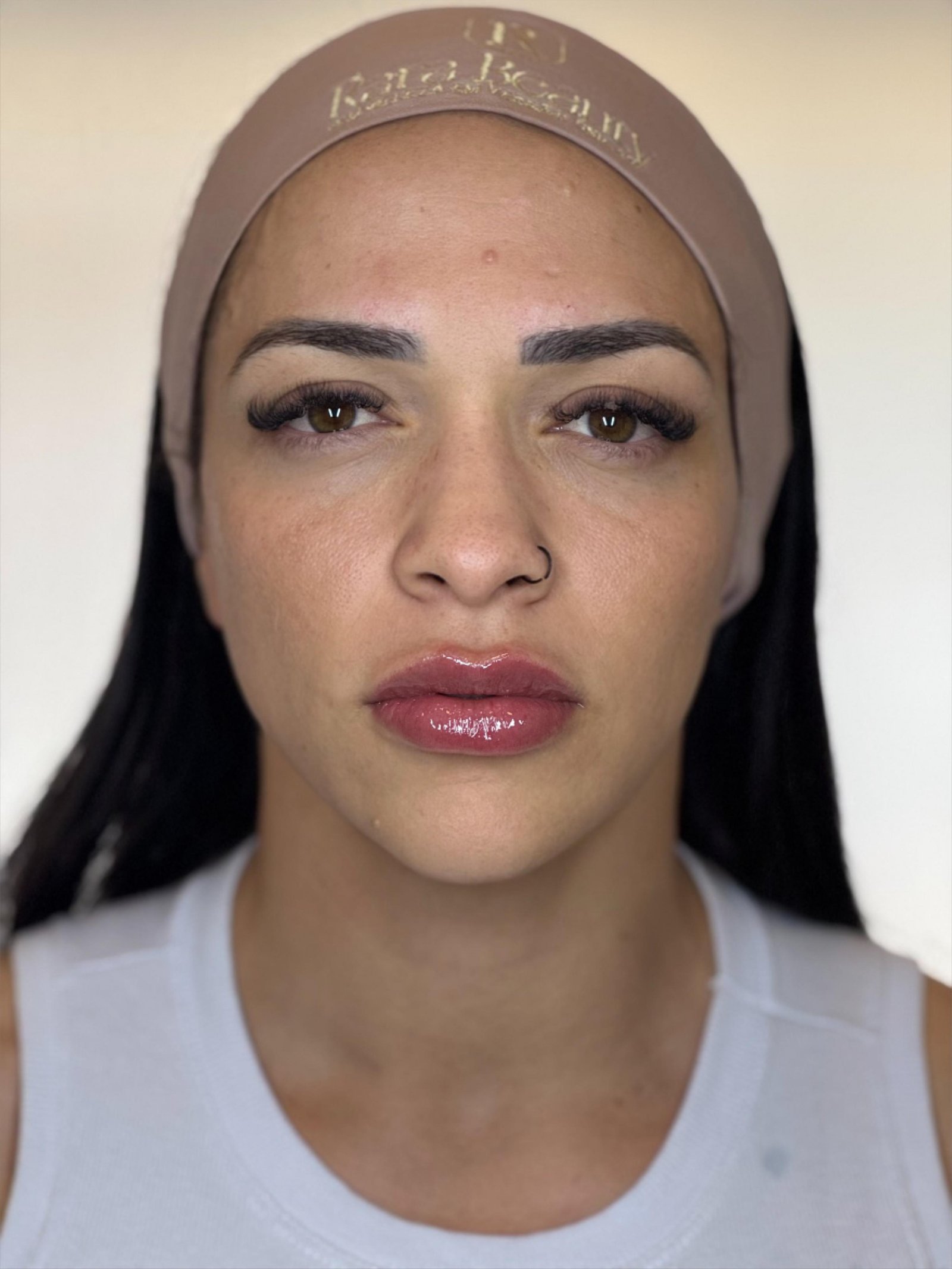 Depois do Preenchimento